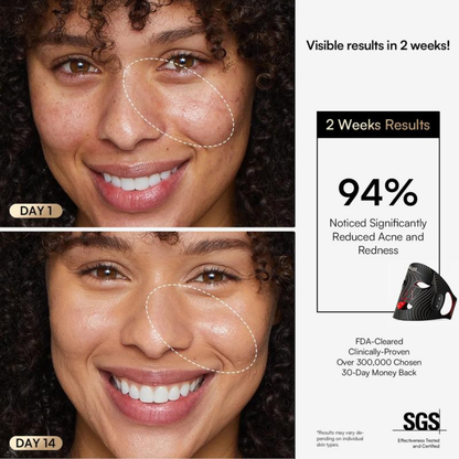 Neck and Chest LED mask