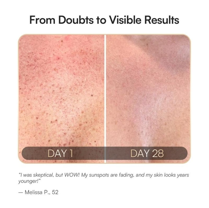 Neck and Chest LED mask